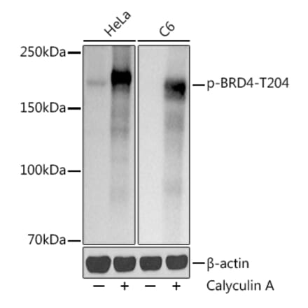 Western Blot - Anti-Brd4 (phospho Thr204) Antibody [ARC50960] (A305446) - Antibodies.com