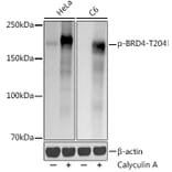 Western Blot - Anti-Brd4 (phospho Thr204) Antibody [ARC50960] (A305446) - Antibodies.com