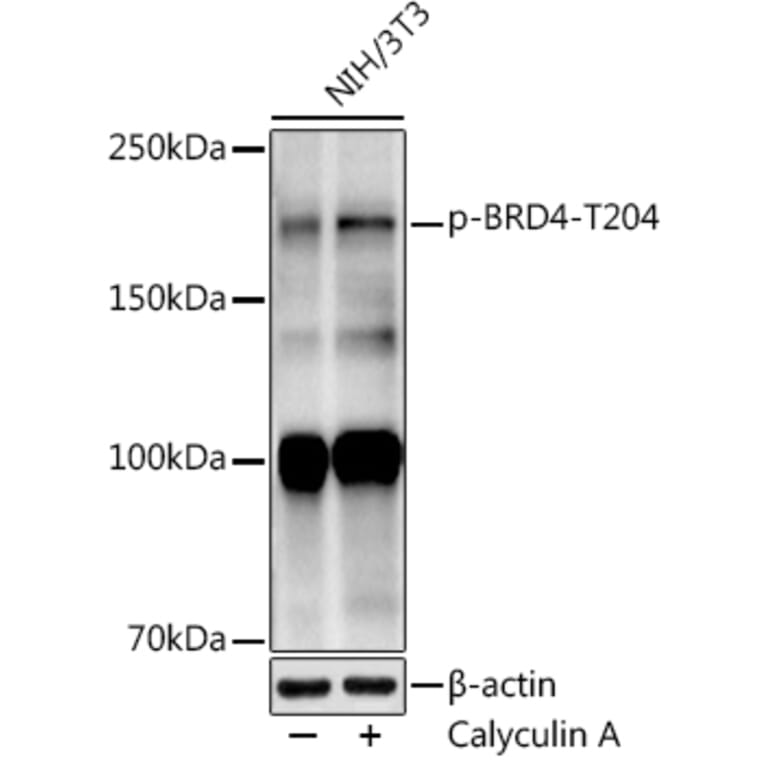 Western Blot - Anti-Brd4 (phospho Thr204) Antibody [ARC50960] (A305446) - Antibodies.com