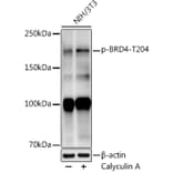 Western Blot - Anti-Brd4 (phospho Thr204) Antibody [ARC50960] (A305446) - Antibodies.com