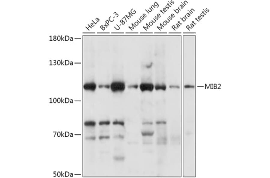 Western Blot - Anti-Skeletrophin/Mib2 Antibody (A305448) - Antibodies.com