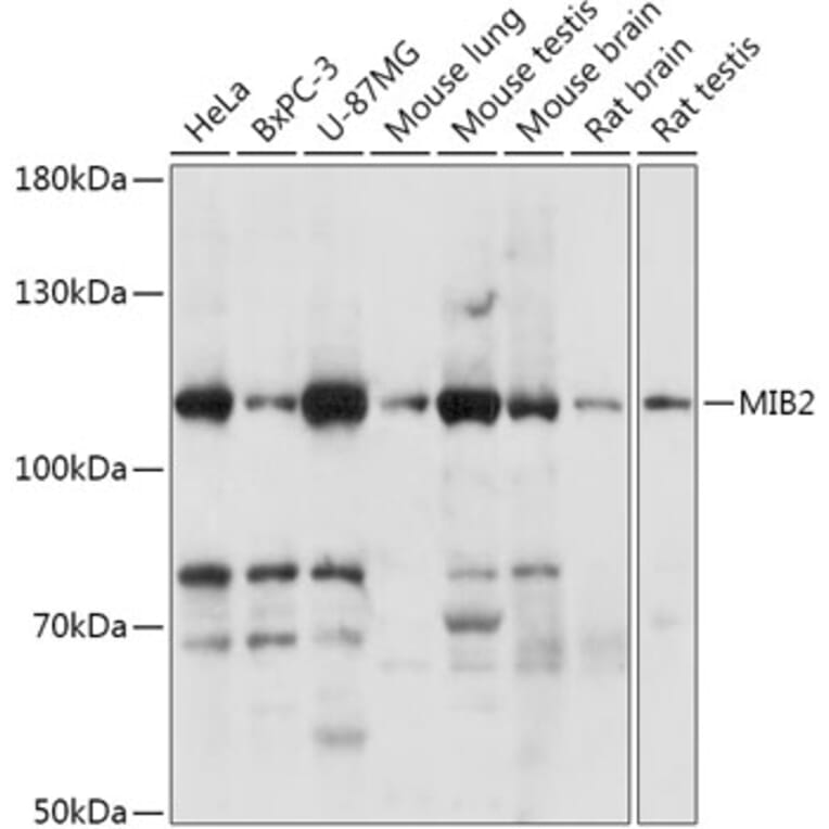 Western Blot - Anti-Skeletrophin/Mib2 Antibody (A305448) - Antibodies.com