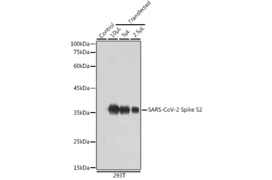 Western Blot - Anti-SARS-CoV-2 Spike Glycoprotein S2 Antibody (A305449) - Antibodies.com