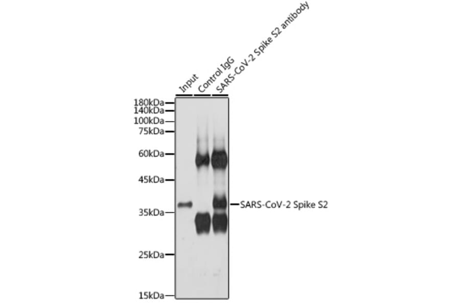 Western Blot - Anti-SARS-CoV-2 Spike Glycoprotein S2 Antibody (A305449) - Antibodies.com
