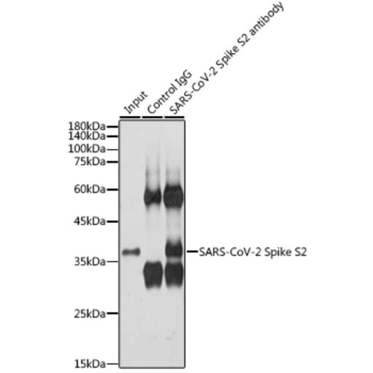 Western Blot - Anti-SARS-CoV-2 Spike Glycoprotein S2 Antibody (A305449) - Antibodies.com