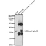 Western Blot - Anti-SARS-CoV-2 Spike Glycoprotein S2 Antibody (A305449) - Antibodies.com