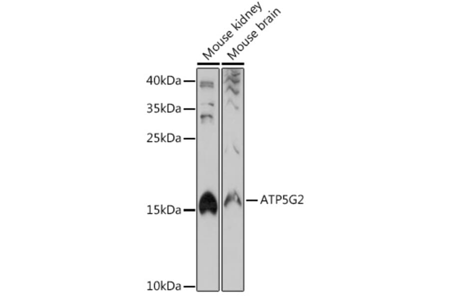 Western Blot - Anti-ATP synthase C Antibody (A305450) - Antibodies.com