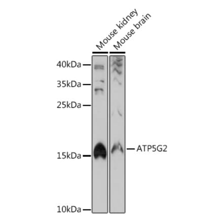 Western Blot - Anti-ATP synthase C Antibody (A305450) - Antibodies.com