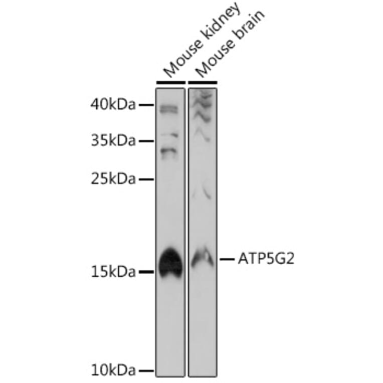 Western Blot - Anti-ATP synthase C Antibody (A305450) - Antibodies.com