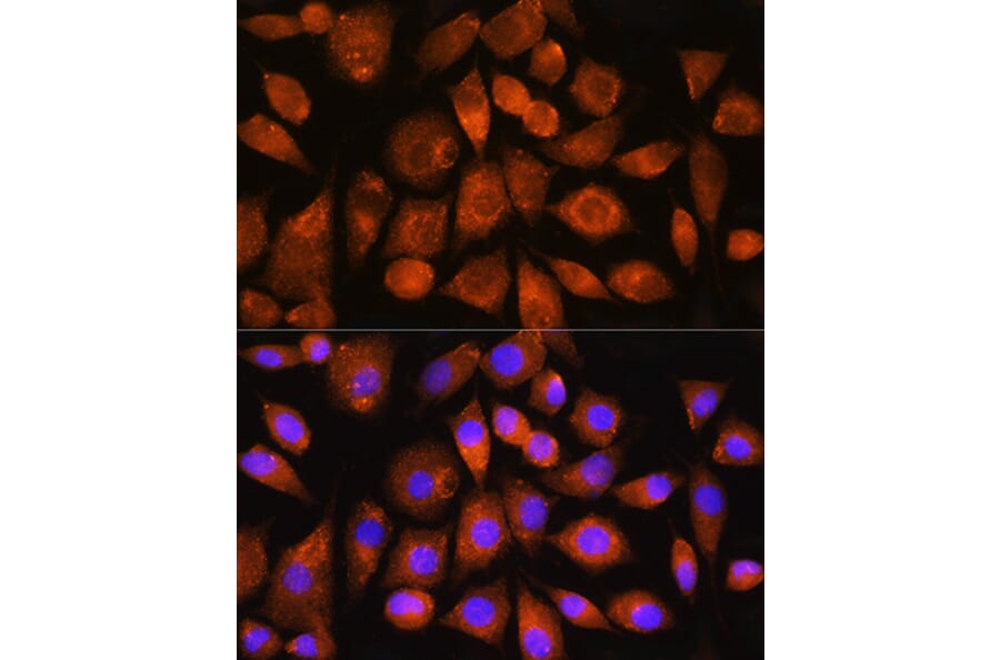 Immunofluorescence - Anti-ATP synthase C Antibody (A305450) - Antibodies.com