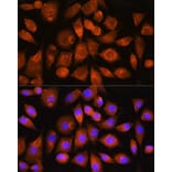Immunofluorescence - Anti-ATP synthase C Antibody (A305450) - Antibodies.com