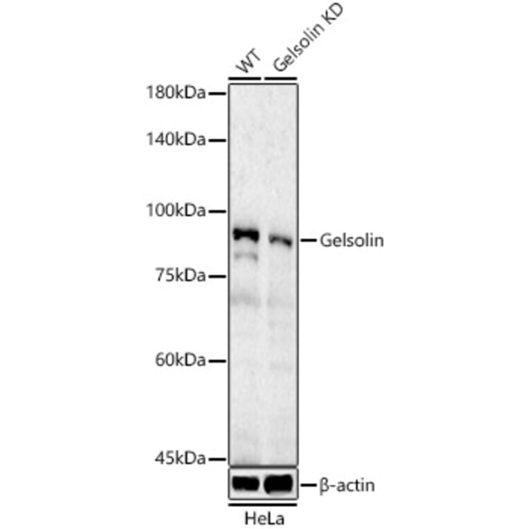 Western Blot - Anti-Gelsolin Antibody (A305452) - Antibodies.com