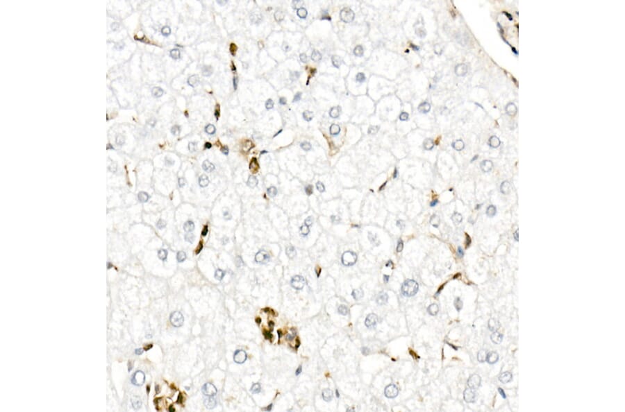 Immunohistochemistry - Anti-Gelsolin Antibody (A305452) - Antibodies.com