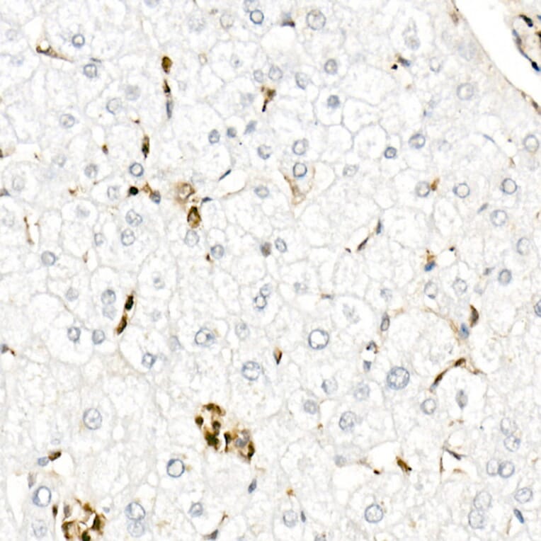 Immunohistochemistry - Anti-Gelsolin Antibody (A305452) - Antibodies.com