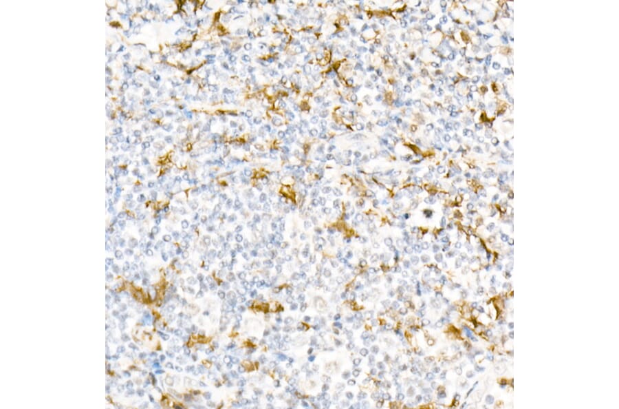 Immunohistochemistry - Anti-Gelsolin Antibody (A305452) - Antibodies.com