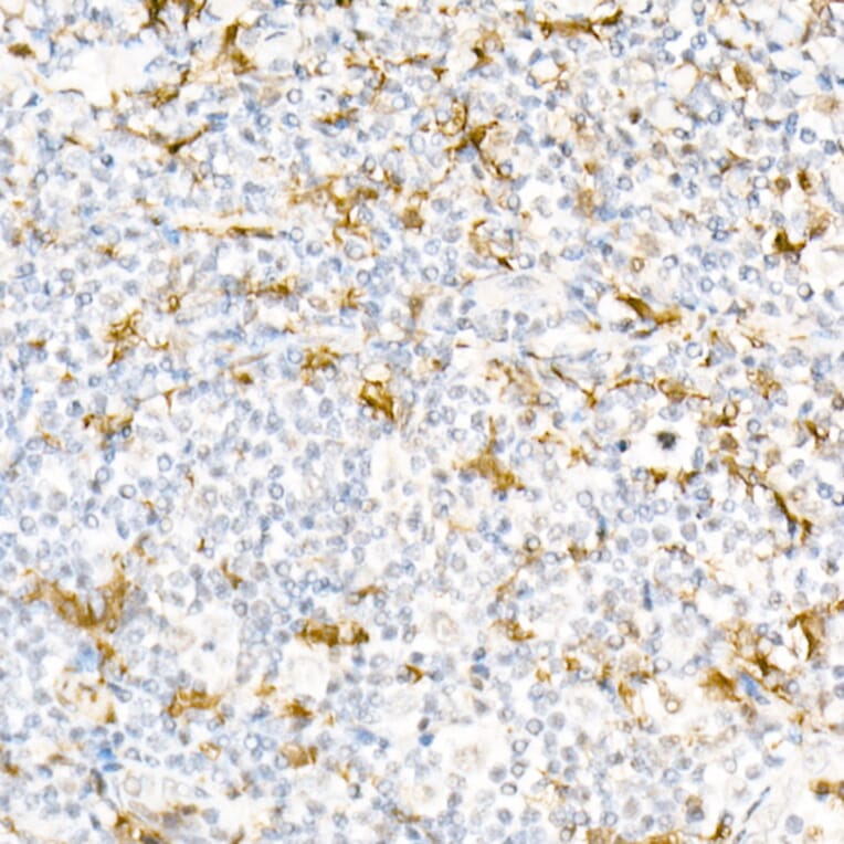 Immunohistochemistry - Anti-Gelsolin Antibody (A305452) - Antibodies.com