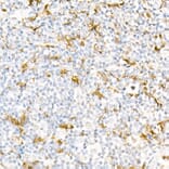 Immunohistochemistry - Anti-Gelsolin Antibody (A305452) - Antibodies.com