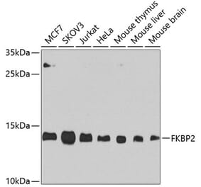 Western Blot - Anti-FKBP2 Antibody (A305453) - Antibodies.com
