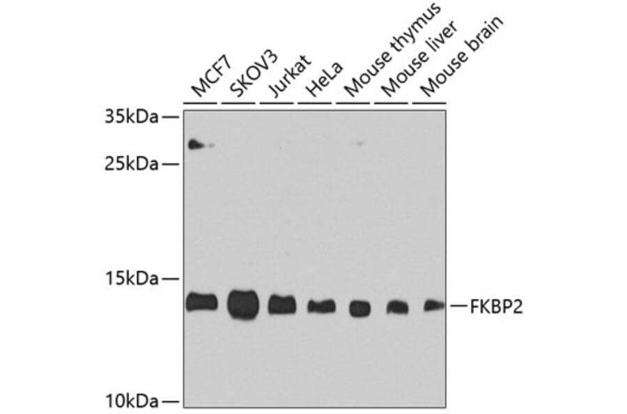 Western Blot - Anti-FKBP2 Antibody (A305453) - Antibodies.com
