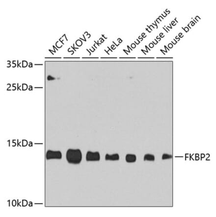 Western Blot - Anti-FKBP2 Antibody (A305453) - Antibodies.com