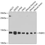 Western Blot - Anti-FKBP2 Antibody (A305453) - Antibodies.com