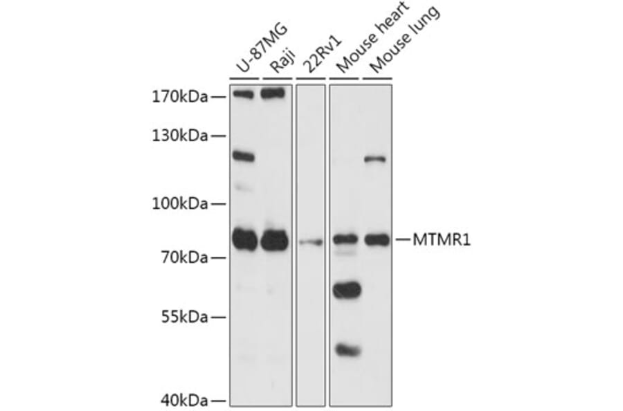 Western Blot - Anti-MTMR1 Antibody (A305455) - Antibodies.com
