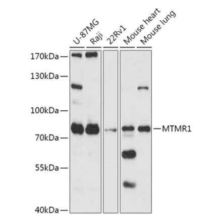 Western Blot - Anti-MTMR1 Antibody (A305455) - Antibodies.com