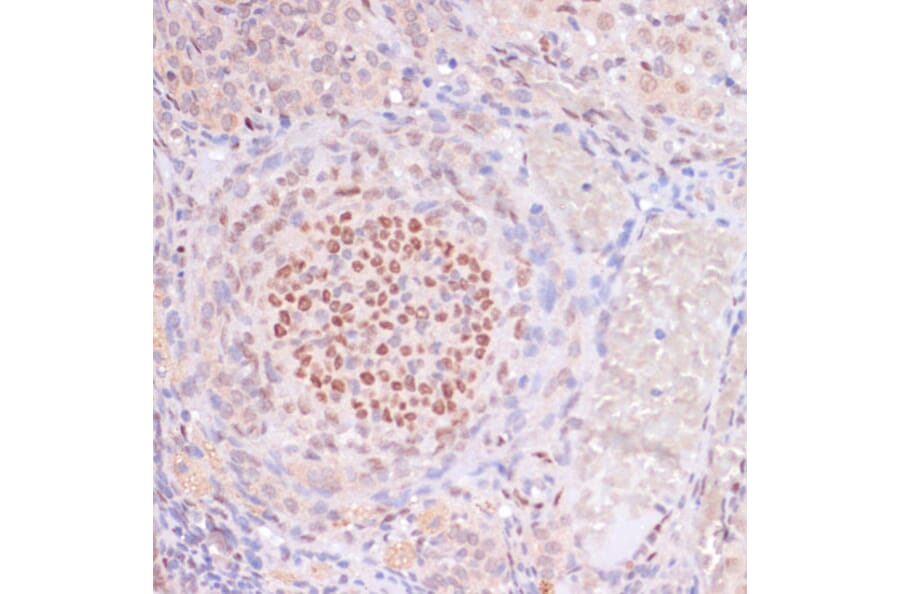 Immunohistochemistry - Anti-Histone H3 (acetyl Lys23) Antibody (A305456) - Antibodies.com