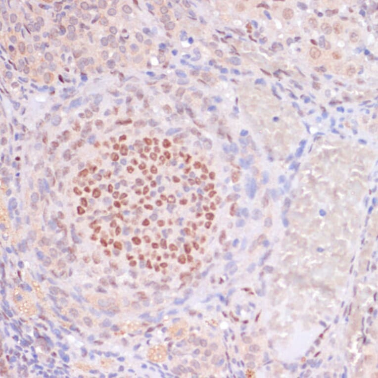 Immunohistochemistry - Anti-Histone H3 (acetyl Lys23) Antibody (A305456) - Antibodies.com