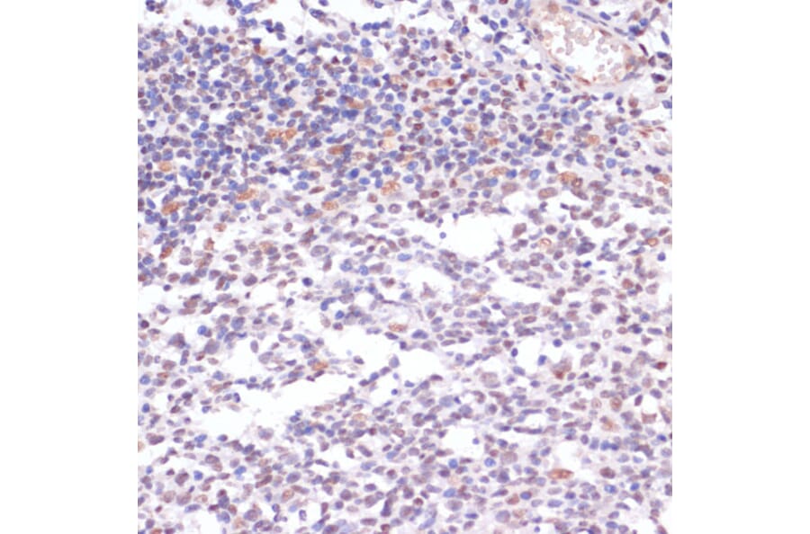 Immunohistochemistry - Anti-Histone H3 (acetyl Lys23) Antibody (A305456) - Antibodies.com