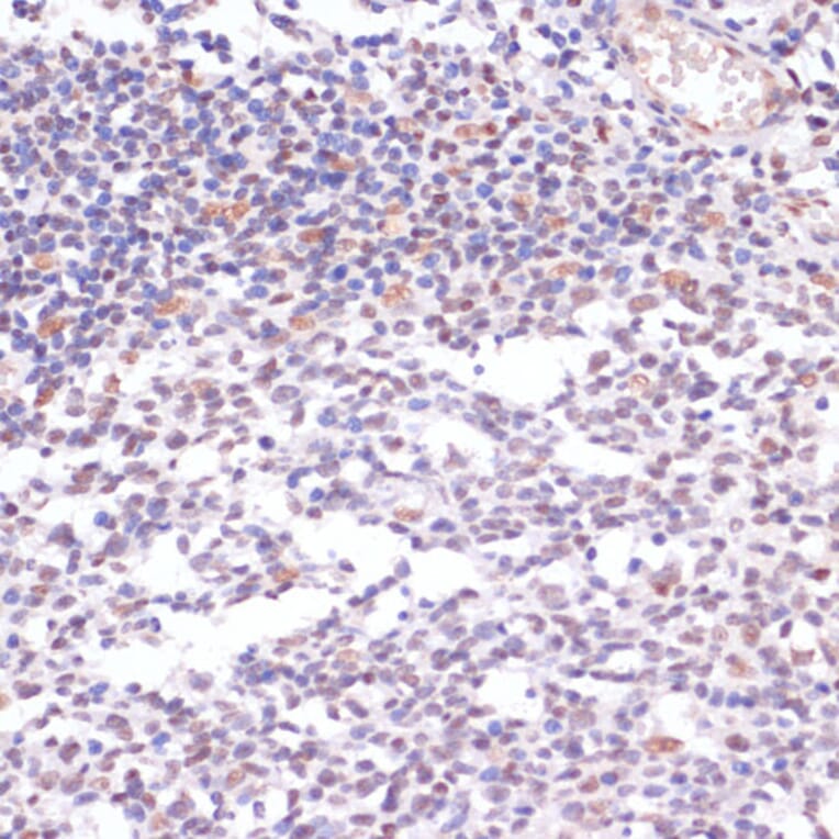 Immunohistochemistry - Anti-Histone H3 (acetyl Lys23) Antibody (A305456) - Antibodies.com