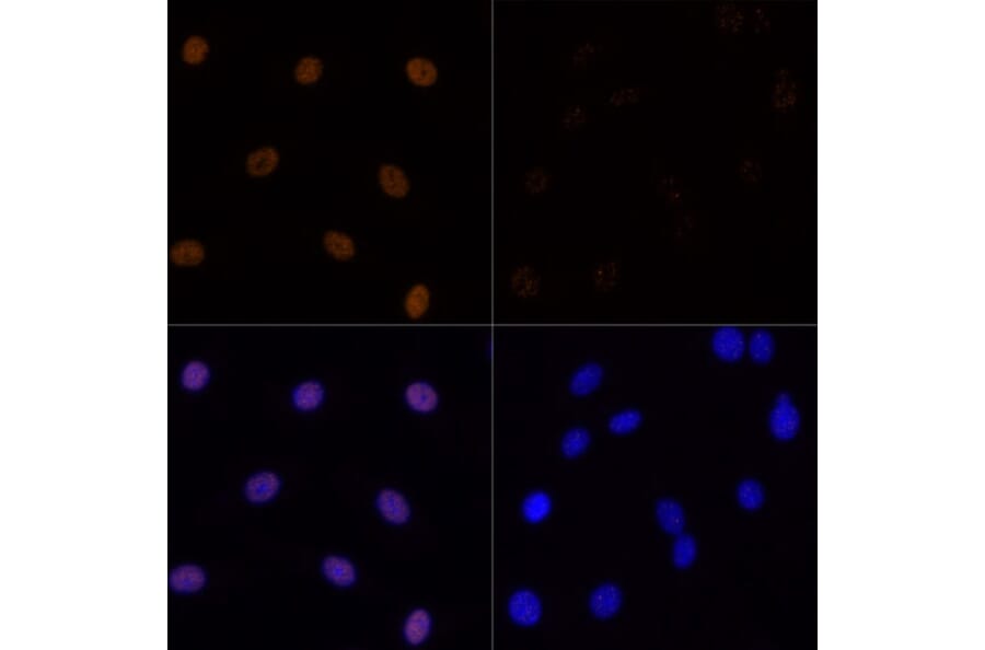 Immunofluorescence - Anti-Histone H3 (acetyl Lys23) Antibody (A305456) - Antibodies.com