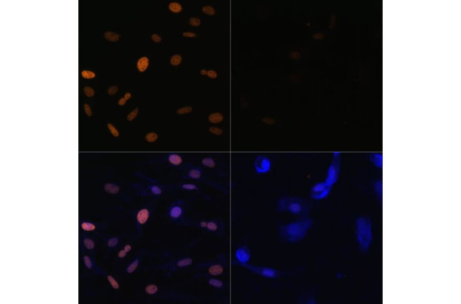Immunofluorescence - Anti-Histone H3 (acetyl Lys23) Antibody (A305456) - Antibodies.com