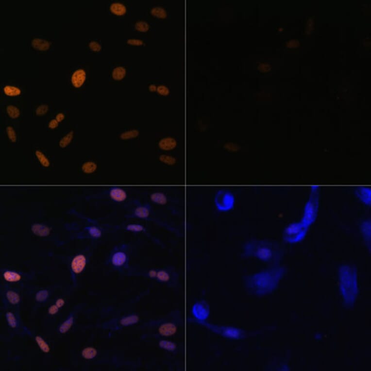 Immunofluorescence - Anti-Histone H3 (acetyl Lys23) Antibody (A305456) - Antibodies.com