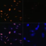 Immunofluorescence - Anti-Histone H3 (acetyl Lys23) Antibody (A305456) - Antibodies.com