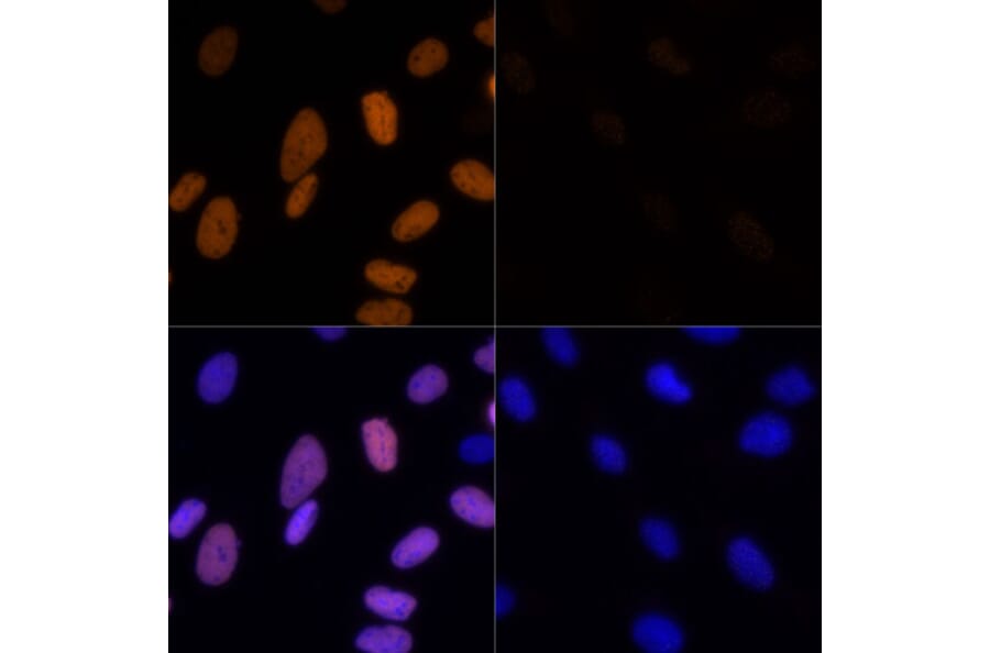 Immunofluorescence - Anti-Histone H3 (acetyl Lys23) Antibody (A305456) - Antibodies.com