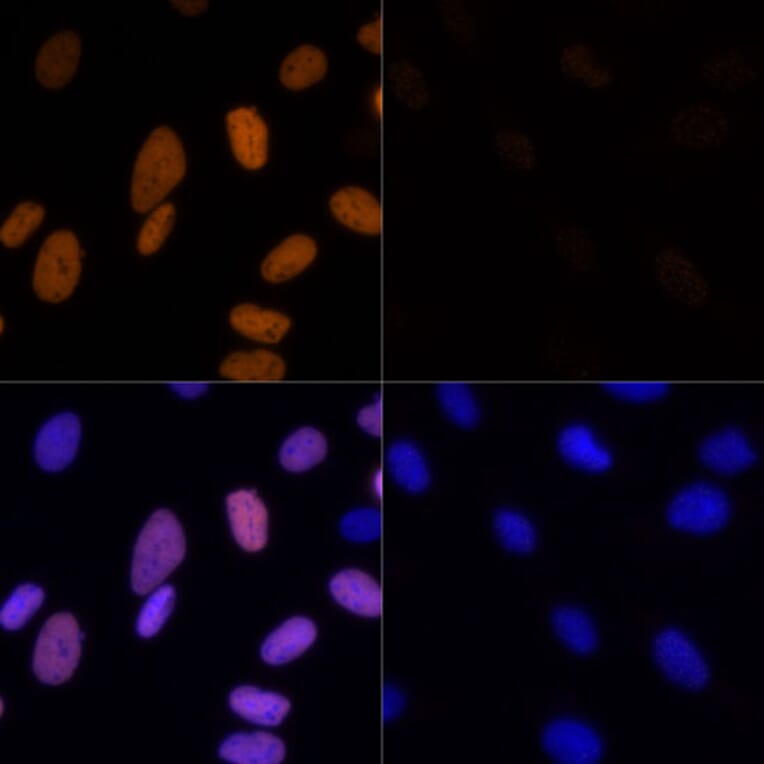 Immunofluorescence - Anti-Histone H3 (acetyl Lys23) Antibody (A305456) - Antibodies.com