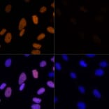 Immunofluorescence - Anti-Histone H3 (acetyl Lys23) Antibody (A305456) - Antibodies.com