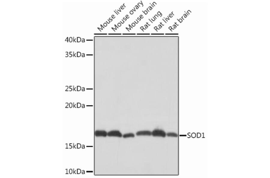Western Blot - Anti-Superoxide Dismutase 1 Antibody [ARC51789] (A305458) - Antibodies.com