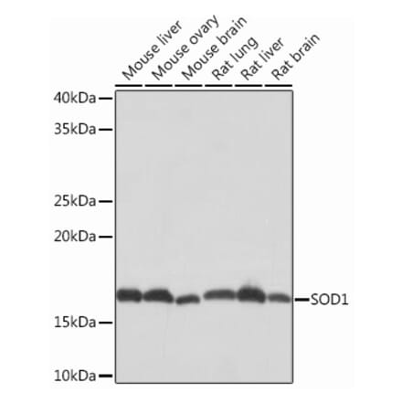 Western Blot - Anti-Superoxide Dismutase 1 Antibody [ARC51789] (A305458) - Antibodies.com