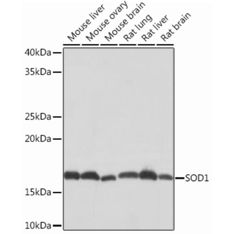 Western Blot - Anti-Superoxide Dismutase 1 Antibody [ARC51789] (A305458) - Antibodies.com