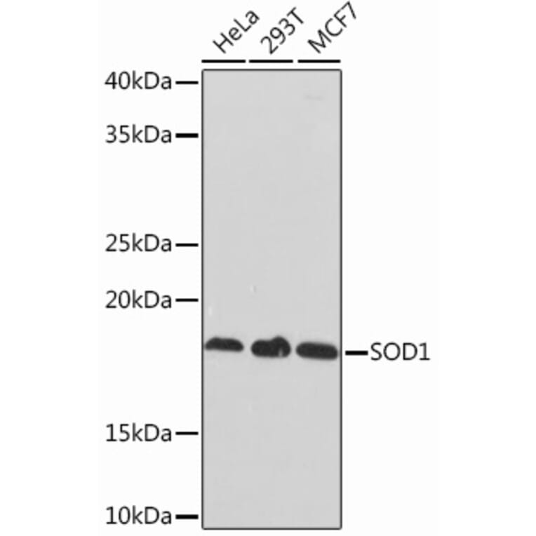 Western Blot - Anti-Superoxide Dismutase 1 Antibody [ARC51789] (A305458) - Antibodies.com