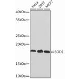 Western Blot - Anti-Superoxide Dismutase 1 Antibody [ARC51789] (A305458) - Antibodies.com