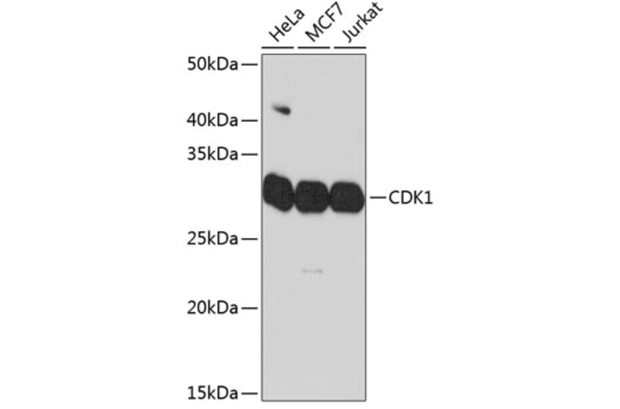 Western Blot - Anti-CDK1 Antibody [ARC50607] (A305462) - Antibodies.com