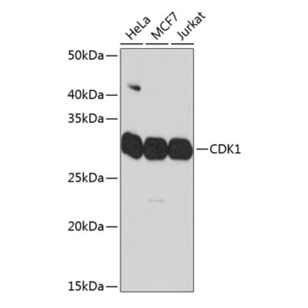 Western Blot - Anti-CDK1 Antibody [ARC50607] (A305462) - Antibodies.com