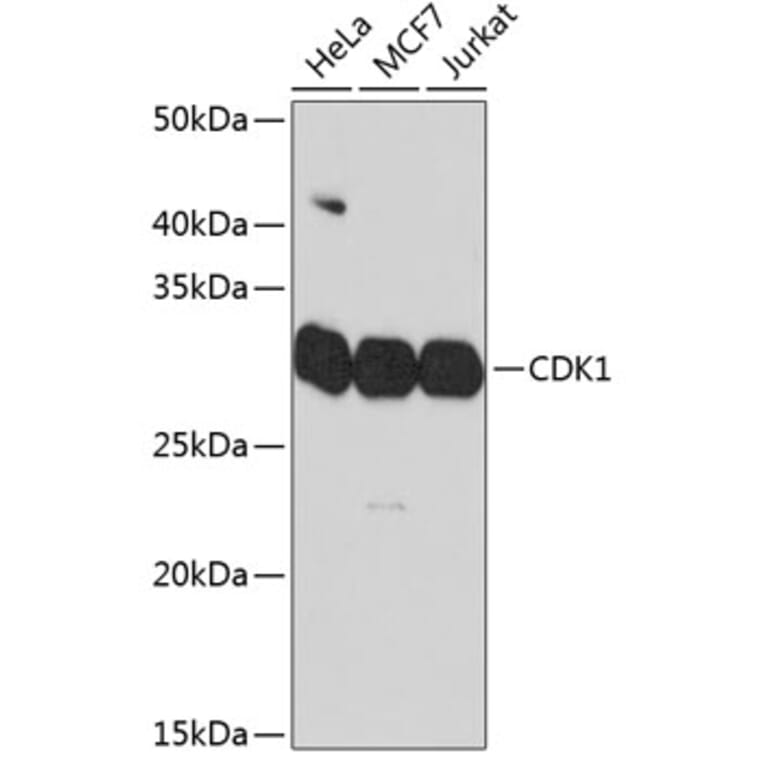 Western Blot - Anti-CDK1 Antibody [ARC50607] (A305462) - Antibodies.com