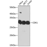 Western Blot - Anti-CDK1 Antibody [ARC50607] (A305462) - Antibodies.com