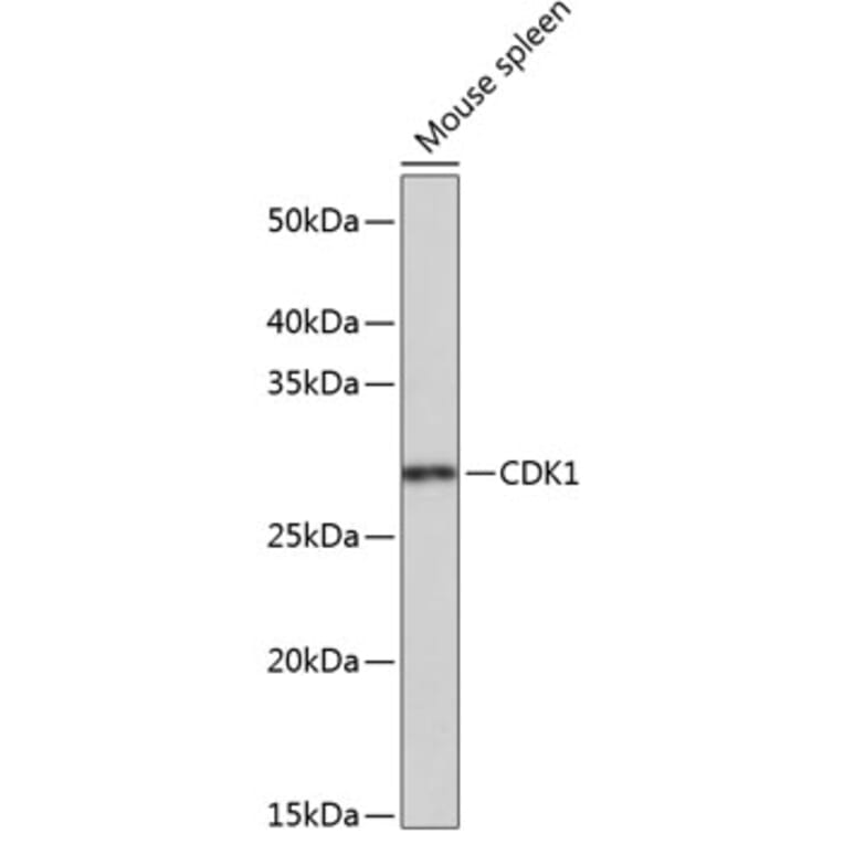 Western Blot - Anti-CDK1 Antibody [ARC50607] (A305462) - Antibodies.com