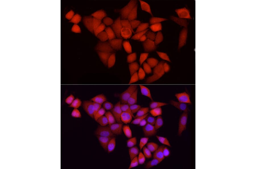 Immunofluorescence - Anti-CDK1 Antibody [ARC50607] (A305462) - Antibodies.com