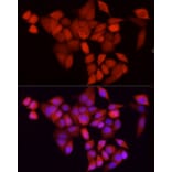 Immunofluorescence - Anti-CDK1 Antibody [ARC50607] (A305462) - Antibodies.com